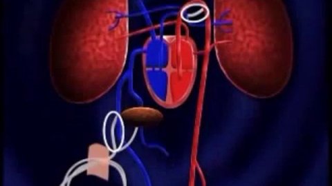 Видео роды!