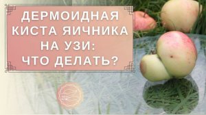 Дермоидная киста яичника на УЗИ_ что делать_ Наталья Петрухина.mp4