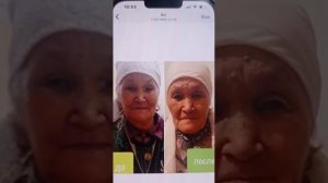 #Глобал Тренд # Результат колосальный , можно избавиться от полипов !!!!