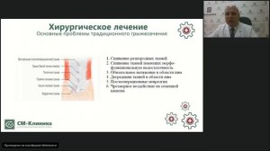 Вебинар 'Грыжи белой линии живота' – Сенько.В.В.