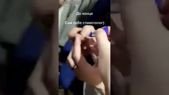 сам себе стоматолог