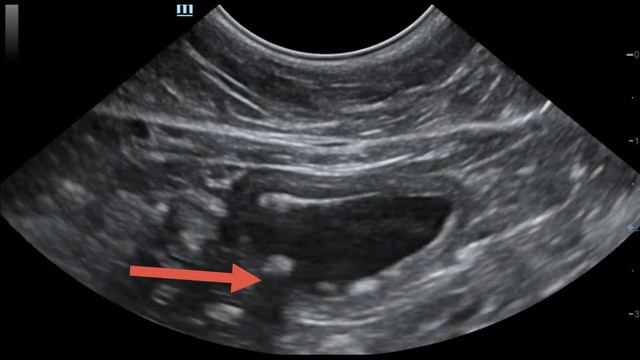Уролиты в мочевом собаки смотреть онлайн