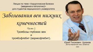 Болезни вен, часть 2 Венозные тромбозы, тромбофлебиты. Лекция для студентов медуниверситета.