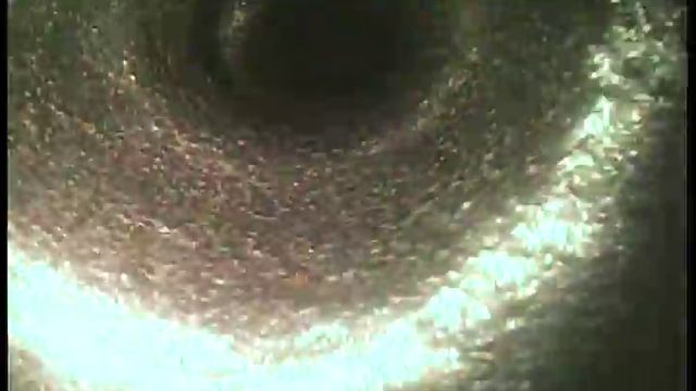 Sample video from Everest Videoscope - close focus tip смотреть онлайн