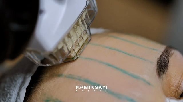 Шлифовка лица (FSR) #KAMINSKYI смотреть онлайн