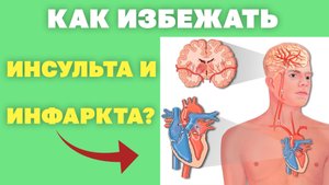 Как защититься от инфаркта, инсульта? Как избежать сердечно сосудистых заболеваний? Упражнения цигун