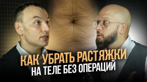 Как убрать растяжки на коже и стрии. Что эффективнее косметология или пластическая хирургия