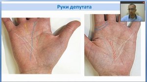 Хиромантия. Знаки богатства. Руки депутата