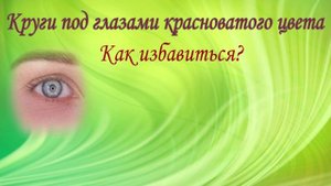 От чего зависит цвет темных кругов под глазами и как с этим бороться.