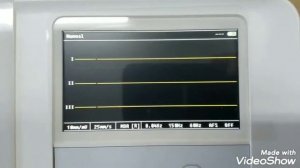 ECG Mediana by Samtronic