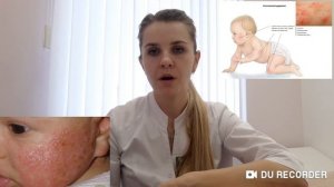 Атопический дерматит у ребёнка!??Как маме помочь самой малышу!