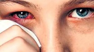 БРЕВНО И СОРИНКА