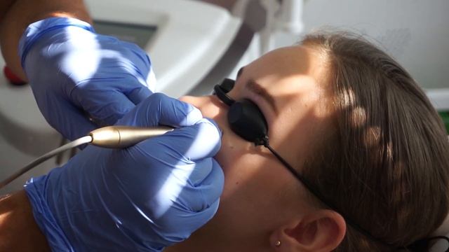 Удаляем Ангиому На Лице смотреть онлайн