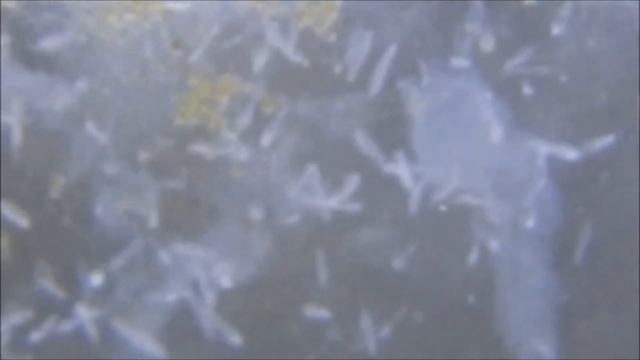 [RICOH WG-50] 1cm macro video (Paramecium) ゾウリムシの接写 смотреть онлайн