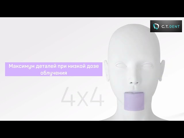 Стоматологический 3D томограф Hyperion X9