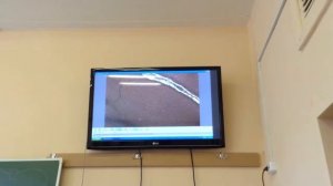 Гистология. Мозжечок и головной мозг Часть#2