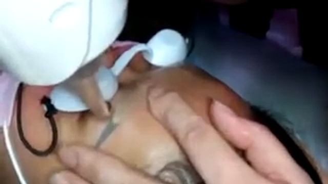 Лазерное удаление татуировка на брови смотреть онлайн