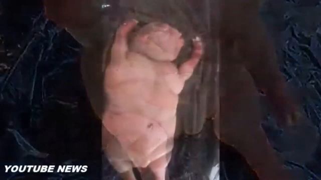 Ужас! Родился человек мутант! Слабонервным не смотреть. Настоящая жесть. смотреть онлайн