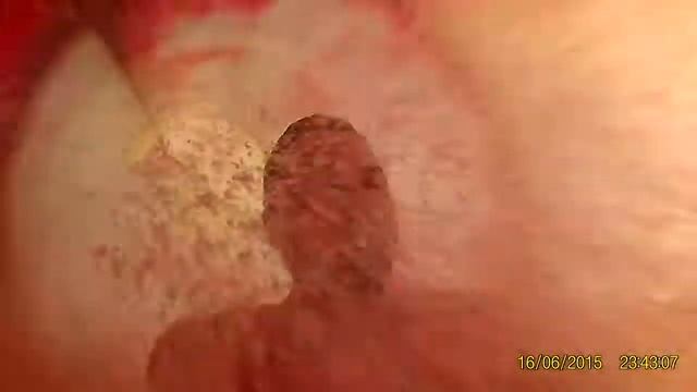 Казань, аквапарк ривьера. смотреть онлайн