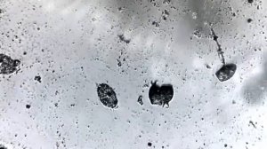 микробы под микроскопом