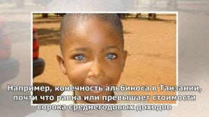 10 любопытных фактов об альбиносах