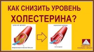 КАК СНИЗИТЬ УРОВЕНЬ ХОЛЕСТЕРИНА