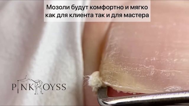 Обработка ногтей с псориазом.#педикюр#мозоли#ногти#аппаратныйпедикюр#пенадляпедикюра#уходзаногами