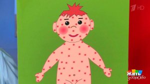 Корь. Детская болезнь. Жить здорово! Фрагмент выпуска от 02.03.2017