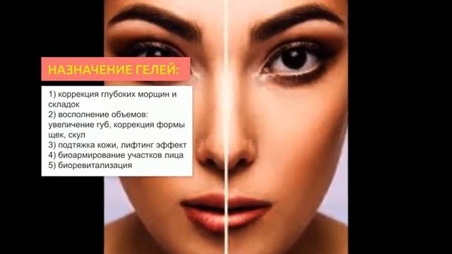 Филлер Rejeunesse Deep | 2Filler.ru