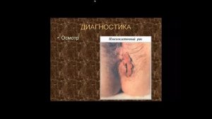 Заболевания прямой кишки