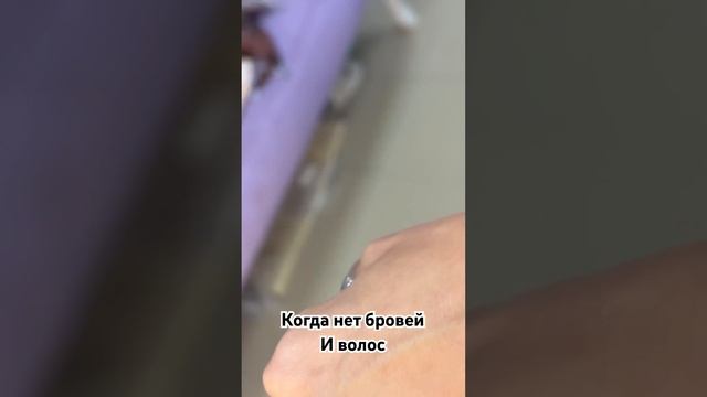 Алопеция ⁉️Нет бровей и волос ⁉️Все решаемо‼️ Девушка сама делает брови . #парик #системазамещения смотреть онлайн