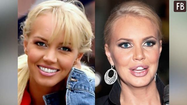 Страшно красивые: 9 отечественных звезд, которые испортили свою внешность пластикой смотреть онлайн