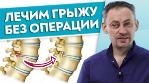 Как избавиться от протрузии навсегда?
Можно ли вылечить ГРЫЖУ без операции?