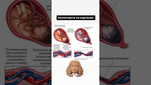 Что такое ДЦП? Почему эта болезнь встречается?