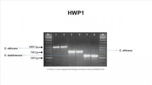 • CARACTERIZACIÓN MOLECULAR Y FENOTIPICA EN INFECCIONES POR CANDIDA ALBICANS ATIPICAS