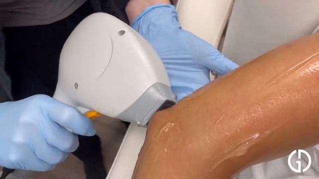 Laser Hair Removal (Arms) | Geria Dermatology смотреть онлайн