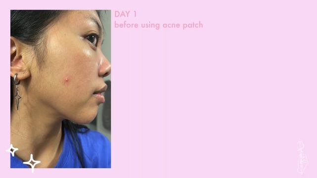 MY *highly requested* SKINCARE ROUTINE! ✨ смотреть онлайн