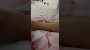 снял гибс через неделю после перелома лодыжки