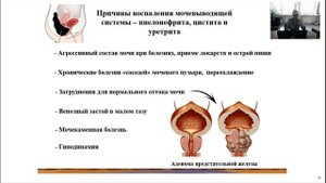 «Мочевой пузырь. Причины, нарушающие его работу»: