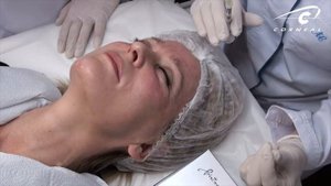 Учимся делать папулы