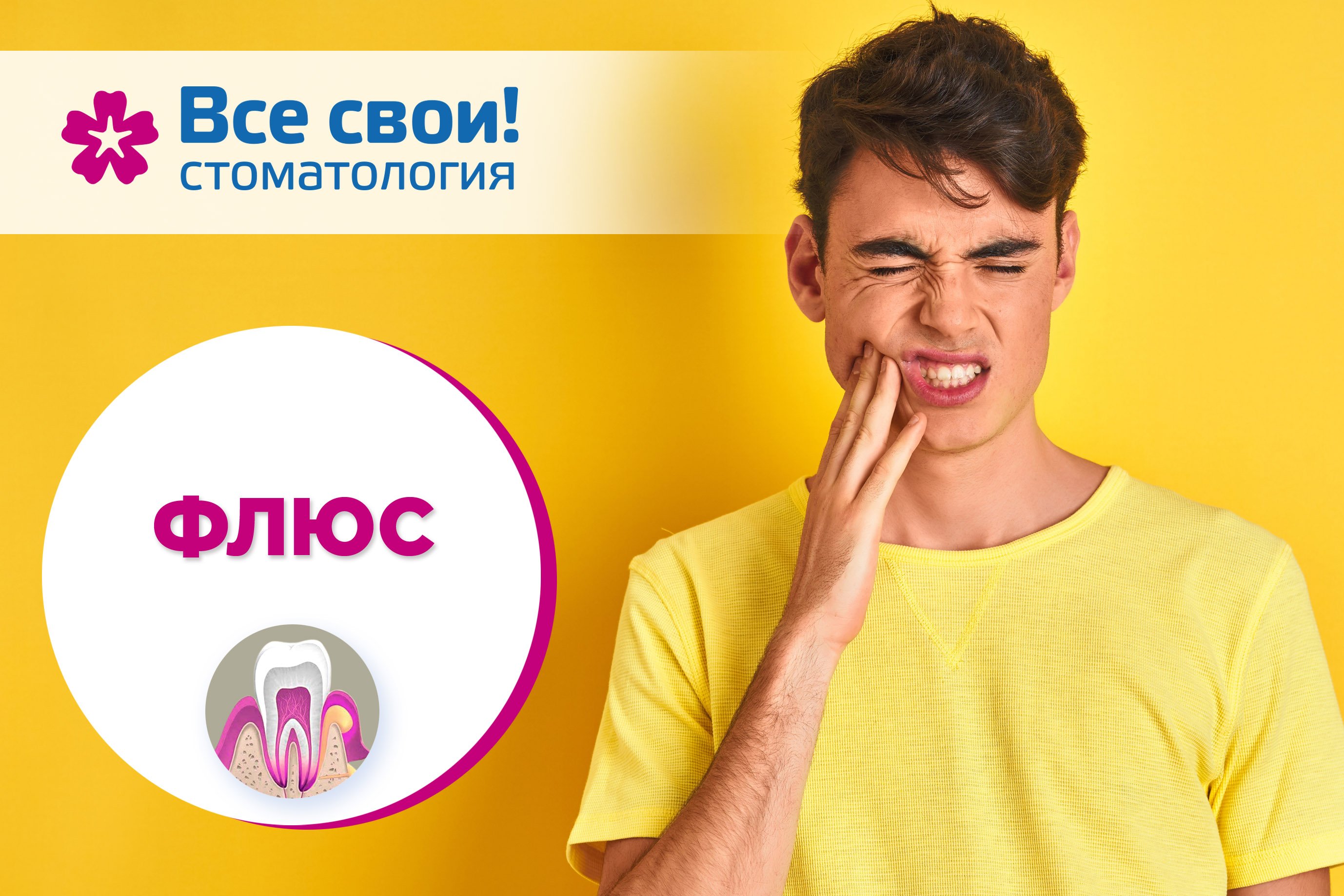 Флюс.