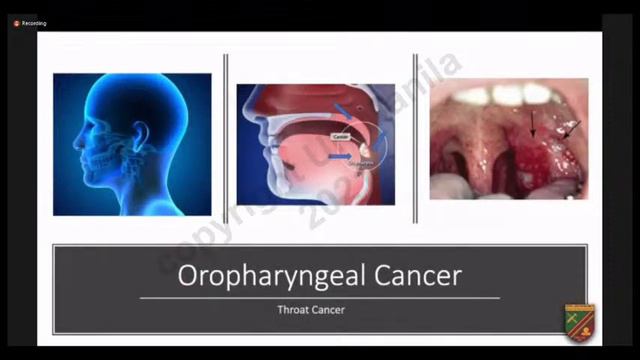 HPV 'Gone Viral!': The Male Connection смотреть онлайн