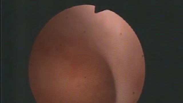 Менструальный цикл женщины. Фаза пролиферации. смотреть онлайн