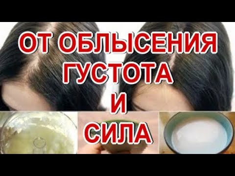 ⛔Настоящий Спасатель от Облысения!⛔ Секрет Трихологов Раскрыт Лечение Облысения!