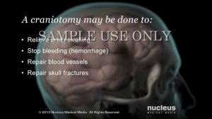 Craniotomy and Craniectomy