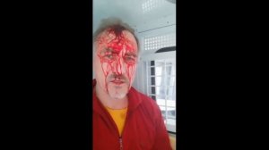 беспредел ментов. скрутили разбили голову