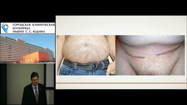 САРС. Рабочая встреча №5. Возможности анальгезии смотреть онлайн