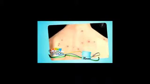 Черемша (колба).Живой разговор о пользе и вреде.... смотреть онлайн