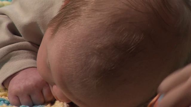 Flat Head Syndrome - Boys Town Pediatrics смотреть онлайн