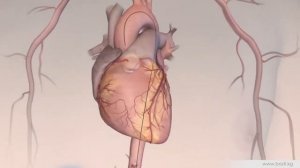 КОРОНАРНЫЙ СТЕНТ